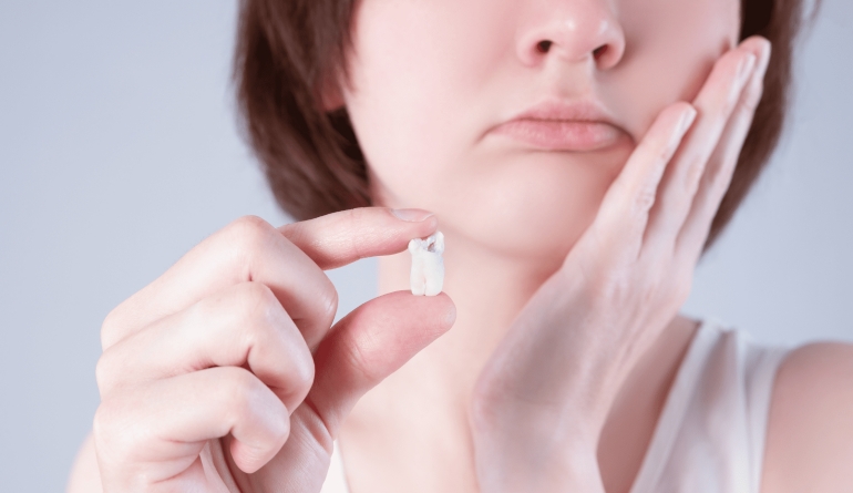 Wisdom Tooth Extraction in Goregaon When and Why You Need It