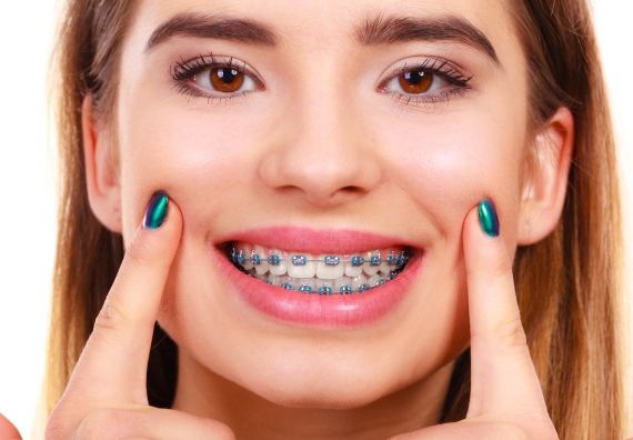 Braces Treatment Goregaon