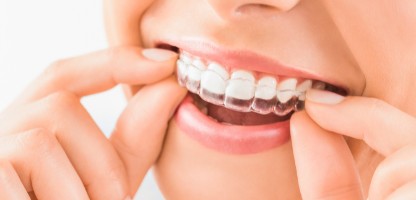 Invisalign in Goregaon