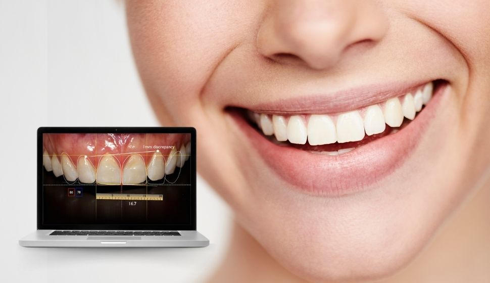 Digital Smile Designing in Goragaon