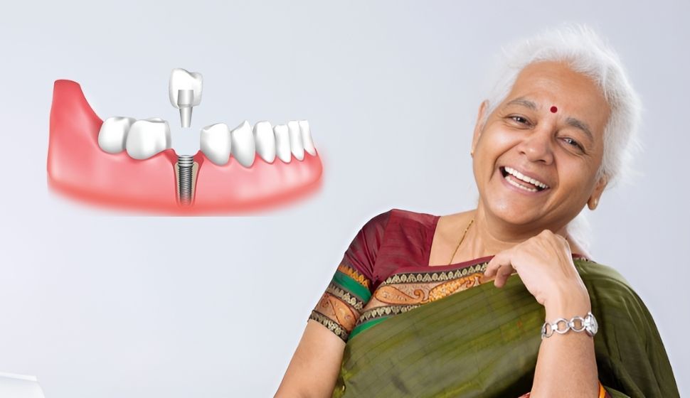 fix teeth in a day in Goregaon