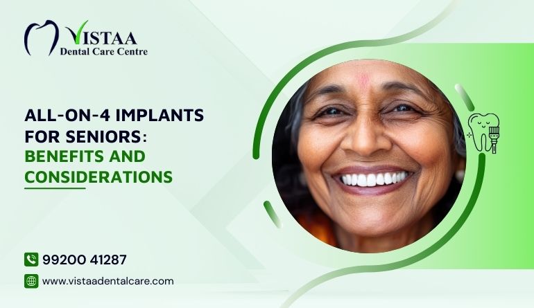 All-on-4 Implants for Seniors: Benefits and Considerations